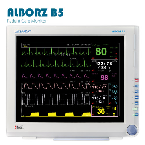 alborzb5-1